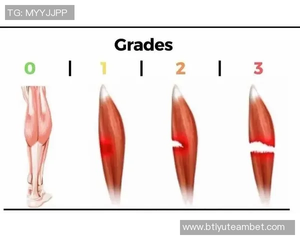 肌肉拉伤恢复指南：轻度1到2周重度需手术停训至少三个月